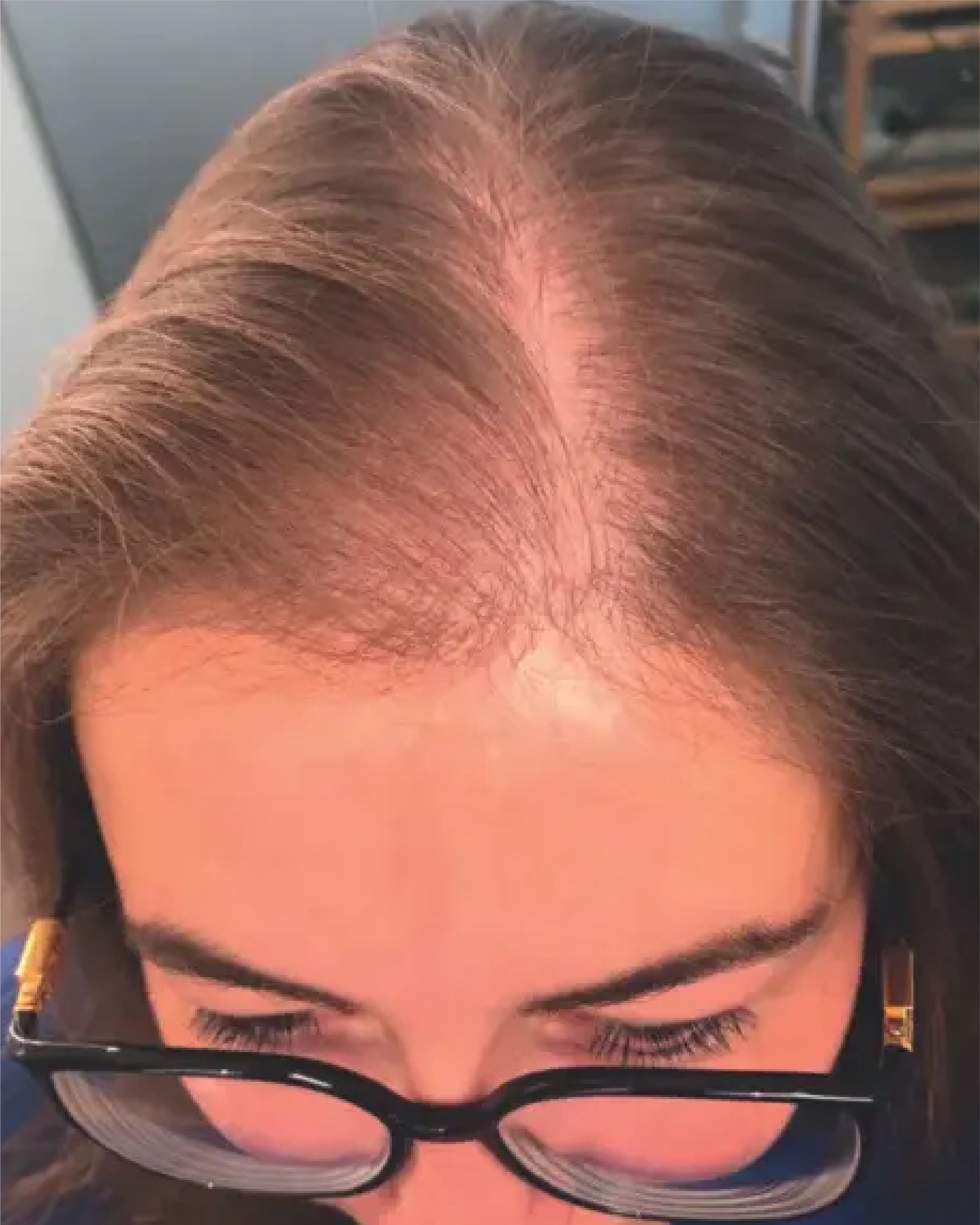 Before Image