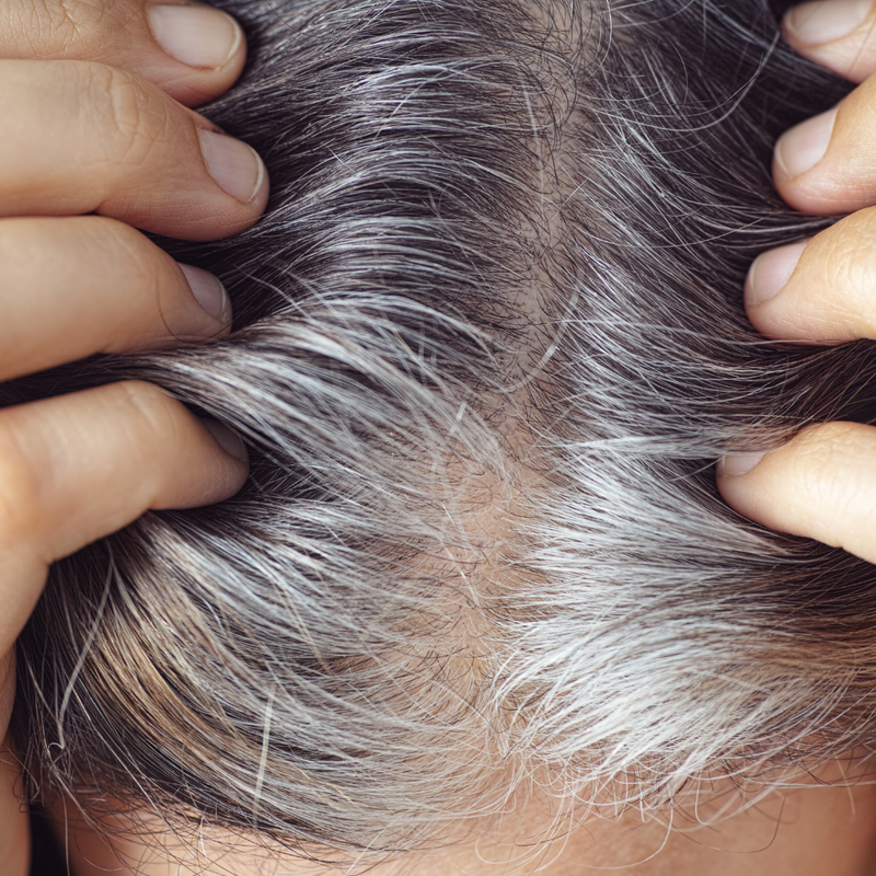 A woman massaging Ashwagandha oil into her scalp