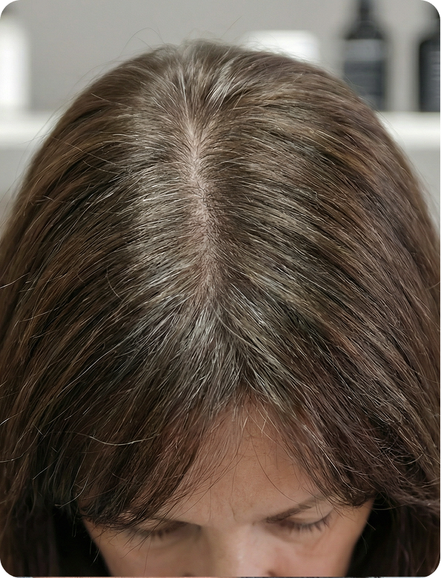 2 months after