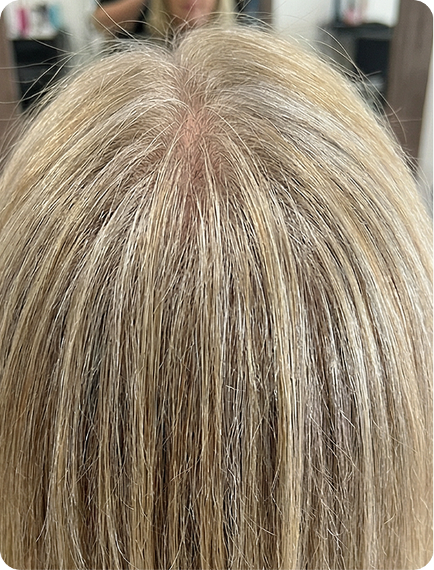 3 months after