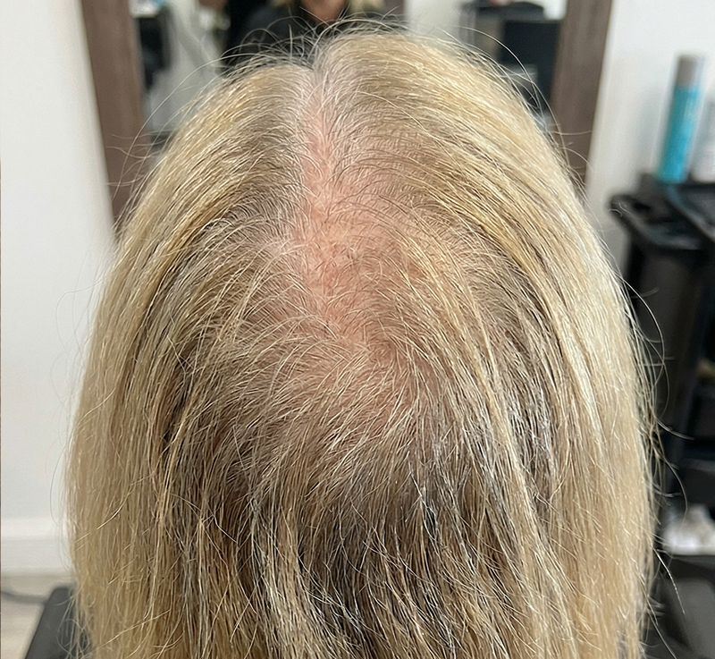 Before Image