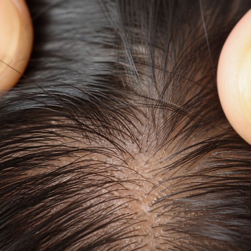 Helps reduce excessive shedding